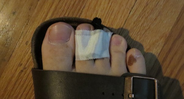 Yes, my dermatologist knows about that mole. Go bug somebody else about their cancer.